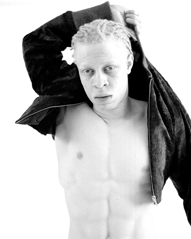 He Over Came The Stigma Of Albinism See Photos Of Albino Who Overcame The Odds To Become A Model Emeka S Blog
